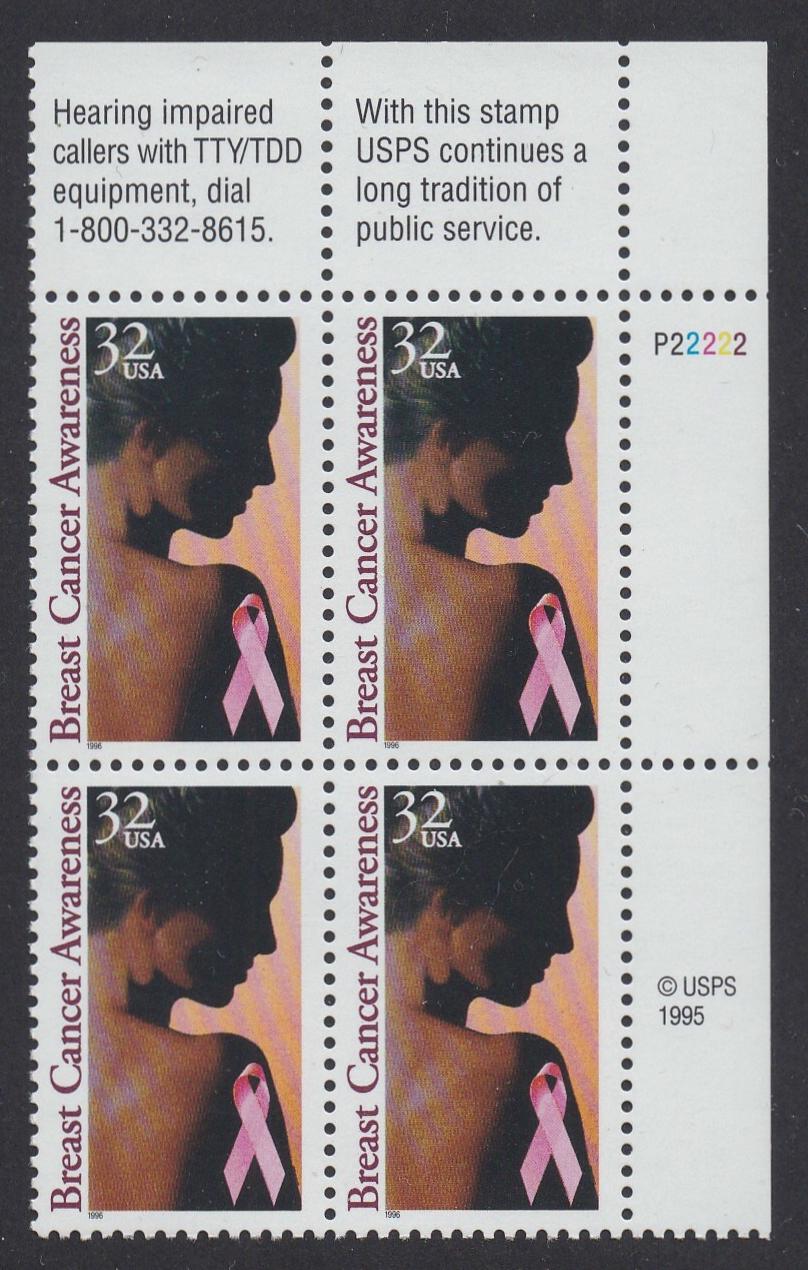 # 3081 (1996) Breast Cancer - PB, UR #P22222, MNH