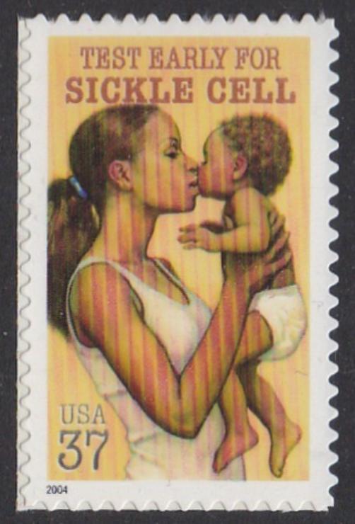 # 3877 (2004) Sickle Cell - Sgl, MNH